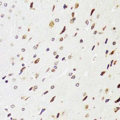 Immunohistochemistry-Paraffin: EDF1 Antibody [NBP2-92882] - Rat brain using EDF1 antibody at dilution of 1:100 (40x lens).
