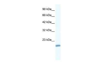 Western Blot: EDF1 Antibody [NBP2-87326] - WB Suggested Anti-EDF1 Antibody Titration: 1.25ug/ml. ELISA Titer: 1:312500. Positive Control: Jurkat cell lysate