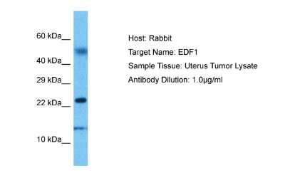 Western Blot: EDF1 Antibody [NBP2-87327] - Host: Rabbit. Target Name: EDF1. Sample Type: Uterus Tumor lysates. Antibody Dilution: 1.0ug/ml