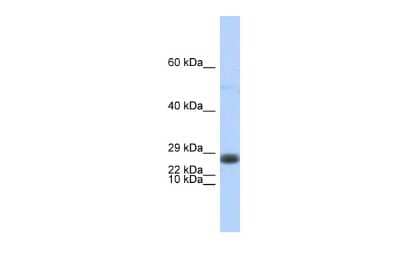 Western Blot: EDF1 Antibody [NBP2-87328] - WB Suggested Anti-EDF1 Antibody Titration: 0.2-1 ug/ml. ELISA Titer: 1:312500. Positive Control: Human brain