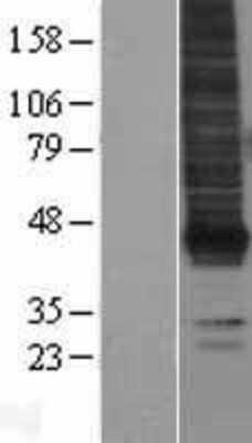 Western Blot: EDG2 Overexpression Lysate (Adult Normal) [NBL1-12643] Left-Empty vector transfected control cell lysate (HEK293 cell lysate); Right -Over-expression Lysate for EDG2.