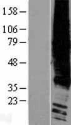 Western Blot: EDG2 Overexpression Lysate (Adult Normal) [NBP2-05802] Left-Empty vector transfected control cell lysate (HEK293 cell lysate); Right -Over-expression Lysate for EDG2.