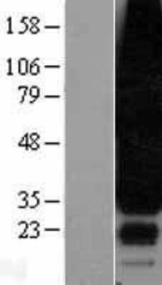 Western Blot: EDG3 Overexpression Lysate (Adult Normal) [NBL1-15667] Left-Empty vector transfected control cell lysate (HEK293 cell lysate); Right -Over-expression Lysate for EDG3.