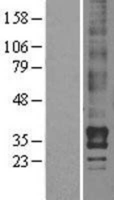 Western Blot: EDG4 Overexpression Lysate (Adult Normal) [NBL1-12645] Left-Empty vector transfected control cell lysate (HEK293 cell lysate); Right -Over-expression Lysate for EDG4.