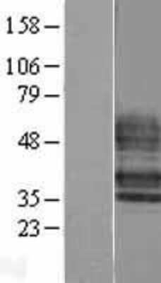 Western Blot: EDG6 Overexpression Lysate (Adult Normal) [NBL1-15668] Left-Empty vector transfected control cell lysate (HEK293 cell lysate); Right -Over-expression Lysate for EDG6.