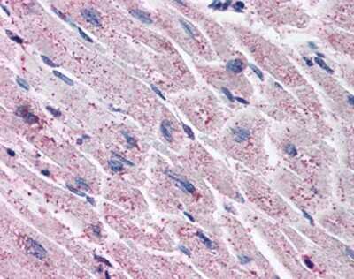 Immunohistochemistry-Paraffin: EDNRA/Endothelin R Type A Antibody [NBP2-29490] - Analysis of anti-Endothelin A Receptor antibody with human heart.