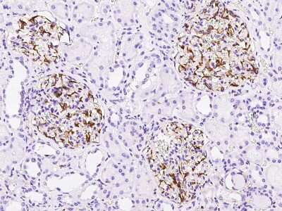 Immunohistochemistry-Paraffin: EDNRA/Endothelin R Type A Antibody [NBP2-99333] - Immunochemical staining of human EDNRA/Endothelin R Type A in human kidney with rabbit polyclonal antibody at 1:300 dilution, formalin-fixed paraffin embedded sections.