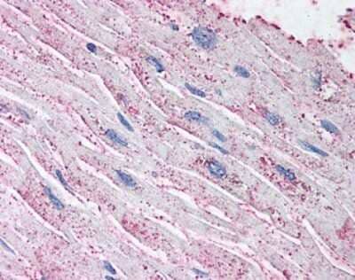 Immunohistochemistry-Paraffin: EDNRA/Endothelin R Type A Antibody [NLS4067] - Analysis of anti-Endothelin A Receptor antibody with human heart.