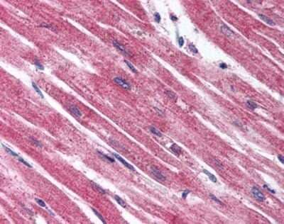 Immunohistochemistry-Paraffin: EDNRA/Endothelin R Type A Antibody [NLS4069] - Analysis of anti-Endothelin A Receptor antibody with human heart.