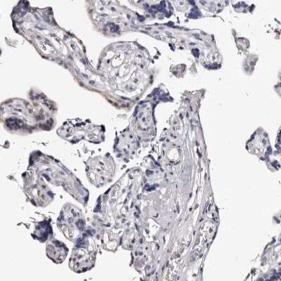 Immunohistochemistry-Paraffin: EDNRB/Endothelin R Type B Antibody [NBP2-38136] - Staining of human placenta shows weak positivity in endothelial cells.
