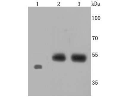 Western Blot: EDNRB/Endothelin R Type B Antibody (JM74-10) [NBP2-66817] - Analysis of Endothelin B Receptor on different cells lysates using anti-Endothelin B Receptor antibody at 1/500 dilution. Positive control: Lane 1: Zebrafish Lane 2: Raji Lane 3: JAR