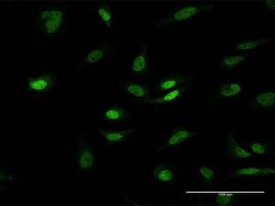 Immunocytochemistry/Immunofluorescence: EDR1/PHC1 Antibody [H00001911-B01P] - Analysis of purified antibody to PHC1 on HeLa cell. (antibody concentration 10 ug/ml)