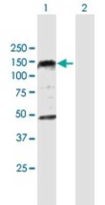 Western Blot: EDR1/PHC1 Antibody [H00001911-B01P] - Analysis of PHC1 expression in transfected 293T cell line by PHC1 polyclonal antibody.  Lane 1: PHC1 transfected lysate(105.27 KDa). Lane 2: Non-transfected lysate.