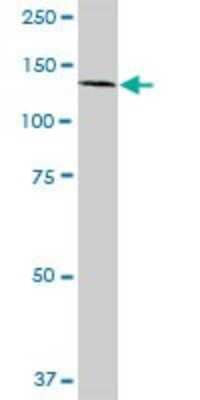 Western Blot: EDR1/PHC1 Antibody [H00001911-D01P] - Analysis of PHC1 expression in human colon.