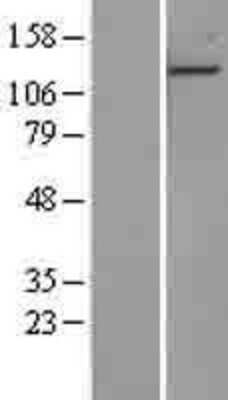 Western Blot: EDR1/PHC1 Overexpression Lysate (Adult Normal) [NBL1-14350] Left-Empty vector transfected control cell lysate (HEK293 cell lysate); Right -Over-expression Lysate for EDR1/PHC1.