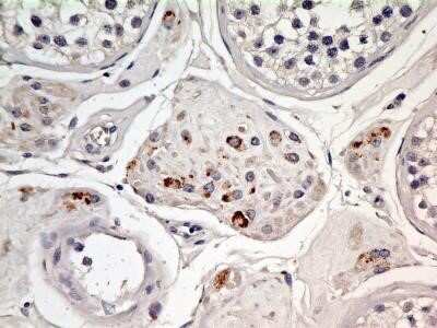 Immunohistochemistry: EEA1 Antibody (6D4.1D4) - Azide and BSA Free [NBP2-80711] - Analysis of FFPE tissue section of human testes using mouse monoclonal EEA1 antibody (clone 6D4.1D4) at 10 ug/ml concentration. The interstitial cells depicted a punctate to granular cytoplasmic staining pattern for EEA1 protein. Image from the standard f