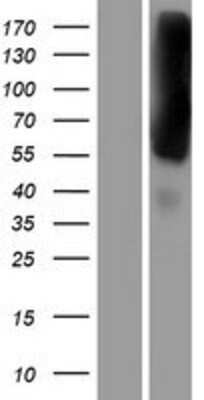 Western Blot EEA1 Overexpression Lysate