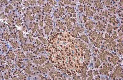 Immunohistochemistry-Paraffin: EED Antibody (GT885) [NBP3-13628] - EED antibody [GT885] detects EED protein at cytoplasm and nucleus by immunohistochemical analysis. Sample: Paraffin-embedded rat endometrial carcinoma. EED stained by EED antibody [GT885] (NBP3-13628) diluted at 1:200. Antigen Retrieval: Citrate buffer, pH 6.0, 15 min