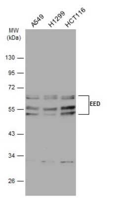 Western Blot EED Antibody (GT885)