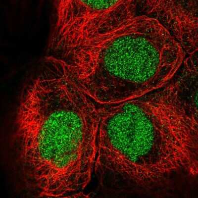 <b>Independent Antibodies Validation. </b>Immunocytochemistry/Immunofluorescence: EED Antibody [NBP2-57195] - Staining of human cell line A-431 shows localization to nucleoplasm.