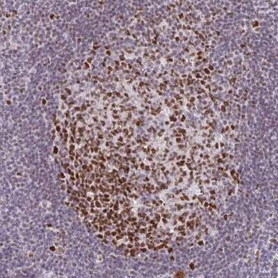 Immunohistochemistry-Paraffin: EED Antibody [NBP2-38907] - Staining of human tonsil shows strong nuclear positivity in germinal center cells.