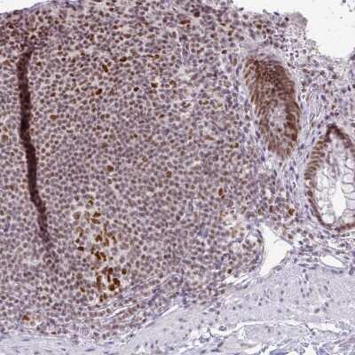 Immunohistochemistry-Paraffin: EED Antibody [NBP2-38907] - Staining of human rectum shows moderate nuclear positivity in glandular cells.