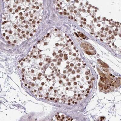 Immunohistochemistry-Paraffin: EED Antibody [NBP2-38907] - Staining of human testis shows moderate to strong nuclear positivity in cells in seminiferous ducts.