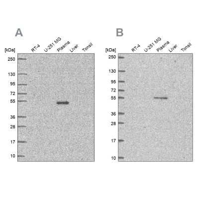 Western Blot: EED Antibody [NBP2-38907] - Analysis using Anti-EED antibody NBP2-38907 (A) shows similar pattern to independent antibody NBP2-57195 (B).