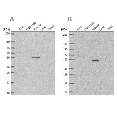 Western Blot: EED Antibody [NBP2-57195] - Analysis using Anti-EED antibody NBP2-57195 (A) shows similar pattern to independent antibody NBP2-38907 (B).