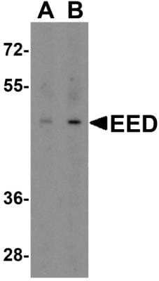 Western Blot: EED Antibody [NBP2-81819] - Analysis of EED in human heart tissue lysate with EED antibody at (A) 1 and (B) 2 ug/ml.