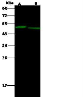 Western Blot: EED Antibody [NBP2-98765] - Lane A: HepG2 Whole Cell LysateLane B: NCI-H1299 Whole Cell LysateLysates/proteins at 30 ug per lane.SecondaryGoat Anti- Rabbit  IgG H&L (Dylight 800)  at 1/10000 dilution.Developed using the Odyssey technique. Performed under reducing conditions.Predicted band size:45 kDaObserved band size:49 kDa