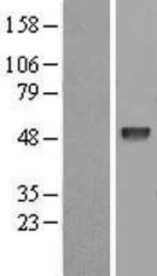 Western Blot EED Overexpression Lysate