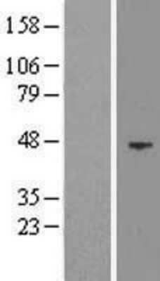 Western Blot EED Overexpression Lysate