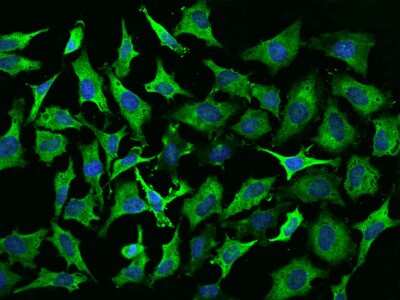 Immunocytochemistry/Immunofluorescence: EEF1A2 Antibody [NBP2-97554] - Immunofluorescence staining of EEF1A2 in Hela cells. Cells were fixed with 4% PFA, permeabilzed with 0.1% Triton X-100 in PBS, blocked with 10% serum, and incubated with rabbit anti-Human EEF1A2 polyclonal antibody (dilution ratio 1:200) at 4C overnight. Then cells were stained with the Alexa Fluor(R)488-conjugated Goat Anti-rabbit IgG secondary antibody (green) and counterstained with DAPI (blue).Positive staining was localized to Cytoplasm.