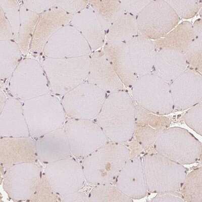 Immunohistochemistry-Paraffin: EEF1A2 Antibody [NBP2-33280] - Staining of human skeletal muscle shows weak cytoplasmic positivity in a subset of myocytes.