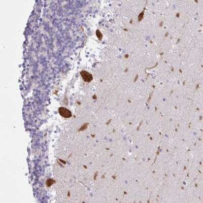 Immunohistochemistry-Paraffin: EEF1A2 Antibody [NBP2-33983] - Staining of human cerebellum shows strong cytoplasmic positivity in Purkinje cells.