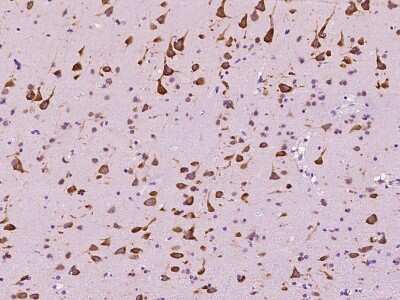 Immunohistochemistry-Paraffin: EEF1A2 Antibody [NBP2-97554] - Immunochemical staining of human EEF1A2 in human brain with rabbit polyclonal antibody at 1:200 dilution, formalin-fixed paraffin embedded sections.