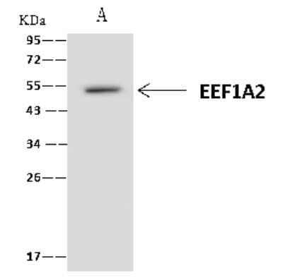 Immunoprecipitation: EEF1A2 Antibody [NBP2-97554] - EEF1A2 was immunoprecipitated using: Lane A: 0.5 mg U-251MG Whole Cell Lysate 4 ul anti-EEF1A2 rabbit polyclonal antibody and 60 ug of Immunomagnetic beads Protein A/G.  Primary antibody: Anti-EEF1A2 rabbit polyclonal antibody, at 1:100 dilution. Secondary antibody: Clean-Blot IP Detection Reagent (HRP) at 1:1000dilution. Developed using the ECL technique. Performed under reducing conditions. Predicted band size: 50 kDa. Observed band size: 50 kDa