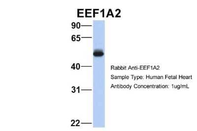 Western Blot: EEF1A2 Antibody [NBP1-55245] - Human Fetal Heart, Antibody Dilution: 1.0 ug/ml.