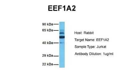 Western Blot: EEF1A2 Antibody [NBP1-55245] - Sample Tissue: Human Jurkat Antibody Dilution: 1.0 ug/ml