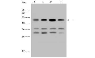 Western Blot: EEF1A2 Antibody [NBP2-97554] - Anti-EEF1A2 rabbit polyclonal antibody at 1:500 dilution. Lane A: HepG2 Whole Cell Lysate Lane B: MCF7 Whole Cell Lysate Lane C: U-251 MG Whole Cell Lysate Lane D: Jurkat Whole Cell Lysate Lysates/proteins at 30 ug per lane. Secondary Goat Anti-Rabbit IgG (H+L)/HRP at 1/10000 dilution. Developed using the ECL technique. Performed under reducing conditions. Predicted band size: 50 kDa. Observed band size: 50 kDa