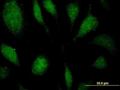 Immunocytochemistry/Immunofluorescence: EEF1D Antibody (4B12) [H00001936-M04] - Analysis of monoclonal antibody to EEF1D on HeLa cell. Antibody concentration 10 ug/ml