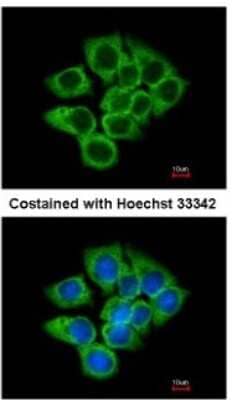 Immunocytochemistry/Immunofluorescence: EEF1D Antibody [NBP1-32013] - Analysis of methanol-fixed A431, using antibody at 1:200 dilution.