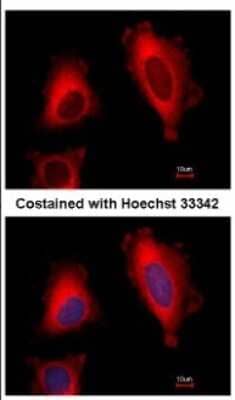 Immunocytochemistry/Immunofluorescence: EEF1D Antibody [NBP2-16273] - Immunofluorescence analysis of methanol-fixed HeLa, using antibody at 1:500 dilution.