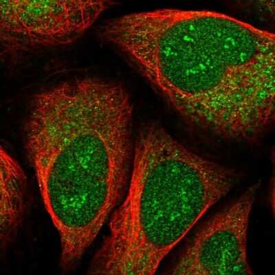 Immunocytochemistry/Immunofluorescence: EEF1D Antibody [NBP2-56820] - Staining of human cell line U-2 OS shows localization to nucleus, nucleoli fibrillar center & cytosol.