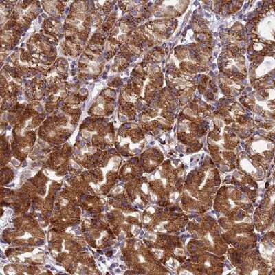 Immunohistochemistry-Paraffin: EEF1D Antibody [NBP1-91861] - Staining of human stomach, upper shows strong cytoplasmic positivity in glandular cells.