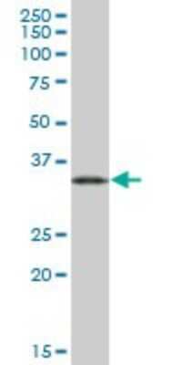 Western Blot: EEF1D Antibody [H00001936-B01P] - Analysis of EEF1D expression in human pancreas.