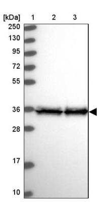 Western Blot: EEF1D Antibody [NBP1-91861] - Lane 1: Marker  [kDa] 250, 130, 95, 72, 55, 36, 28, 17, 10.  Lane 2: Human cell line RT-4.  Lane 3: Human cell line U-251MG sp