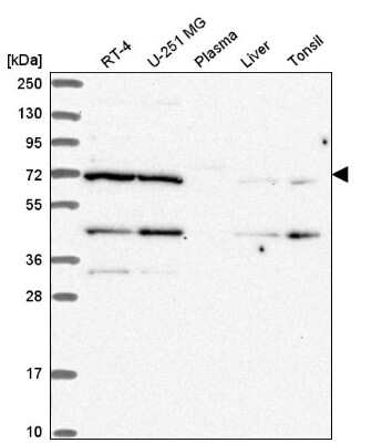 Western Blot: EEF1D Antibody [NBP2-56820] - Western blot analysis in human cell line RT-4, human cell line U-251 MG, human plasma, human liver tissue and human tonsil tissue.