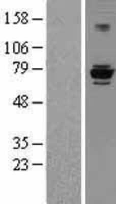 Western Blot: EEF1D Overexpression Lysate (Adult Normal) [NBP2-08159] Left-Empty vector transfected control cell lysate (HEK293 cell lysate); Right -Over-expression Lysate for EEF1D.